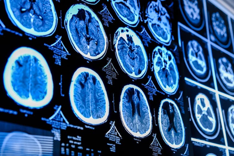 magnetic resonance imaging