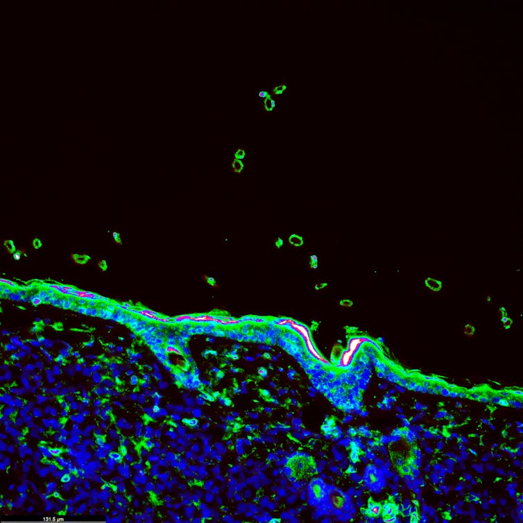 image obtained using immunofluorescence