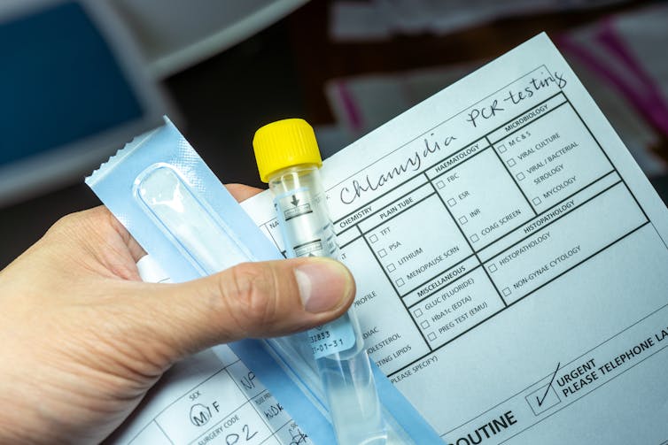 Hand holding swab, vial tube and medical form with 