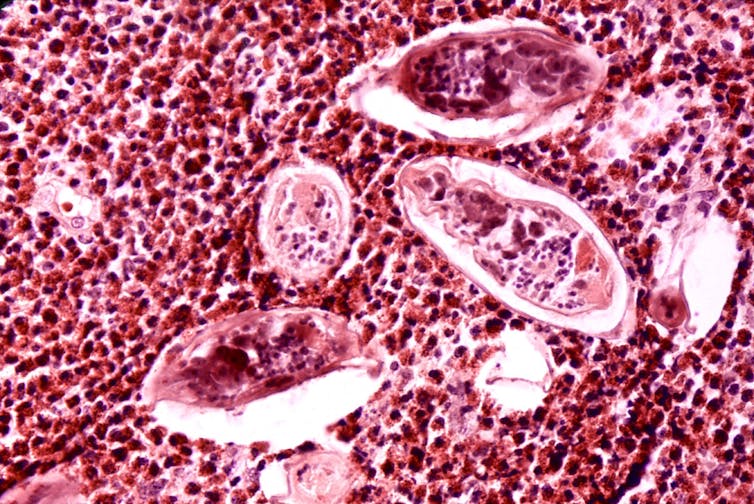 Microscopy image of large white oval-shaped structures enclosing magenta oval-shaped structures, surrounded by smaller cells